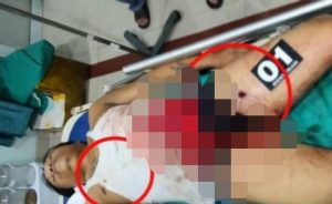 OTK di Siantar Tembak Wartawan hingga Tewas