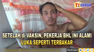 USAI DIVAKSIN, BURUH PABRIK INI ALAMI LUKA SEPERTI TERBAKAR DIKULIT