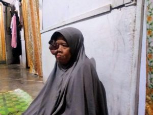 Ibu Juniarsih Berharap Minum Obat Rp5000,- Sembuh Dari Tumor’nya, Ternyata Cuma Hanya?