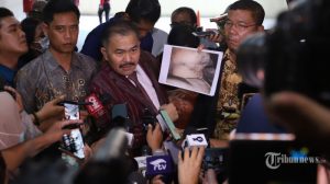 Hasil Autopsi Ulang Brigadir J Menurut Pengacara: Ada Lubang di Kepala yang Tembus ke Hidung