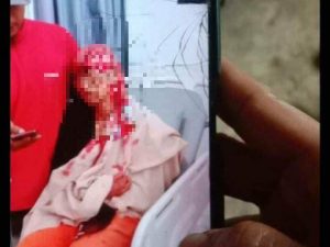 Tragis! Narti Alami Kecelakaan Kerja di CV Bintang Ternak, Luar Biasa.. saat Dikonfirmasi Manager Bungkam
