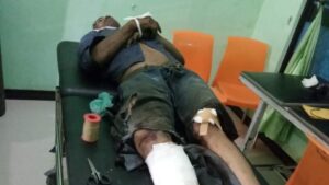 Akibat Tangki Meledak, 4 Orang Pekerja Tewas