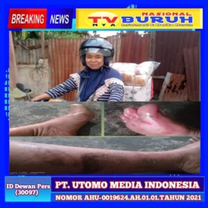 Harirayana Mantan Caleg Partai Buruh Nyaris Diri dan Rumah’nya Terbakar, Kondisinya Memprihatinkan!